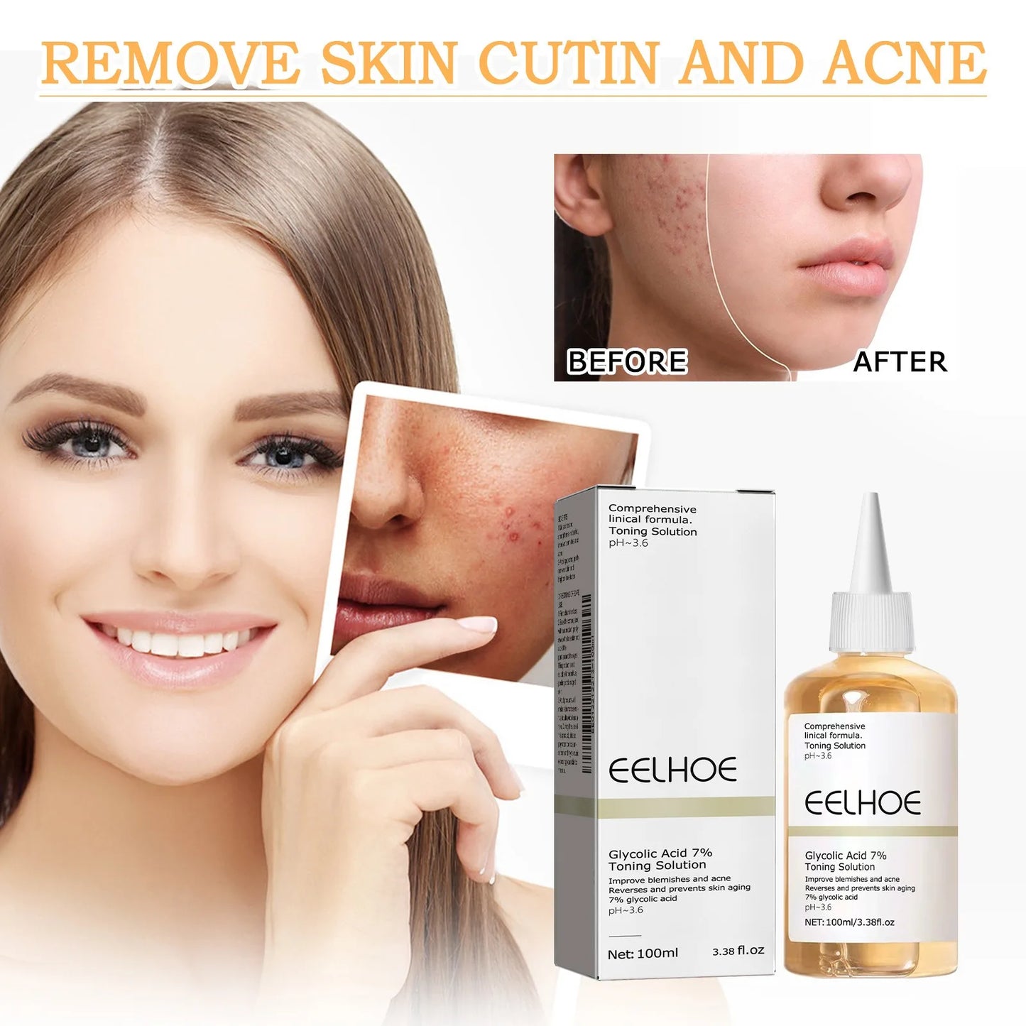 Toning Solution Ordinary Acne Remover