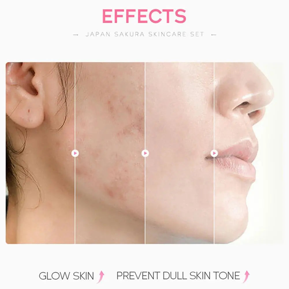 Skin Care Sets Face Cream Serum Toner