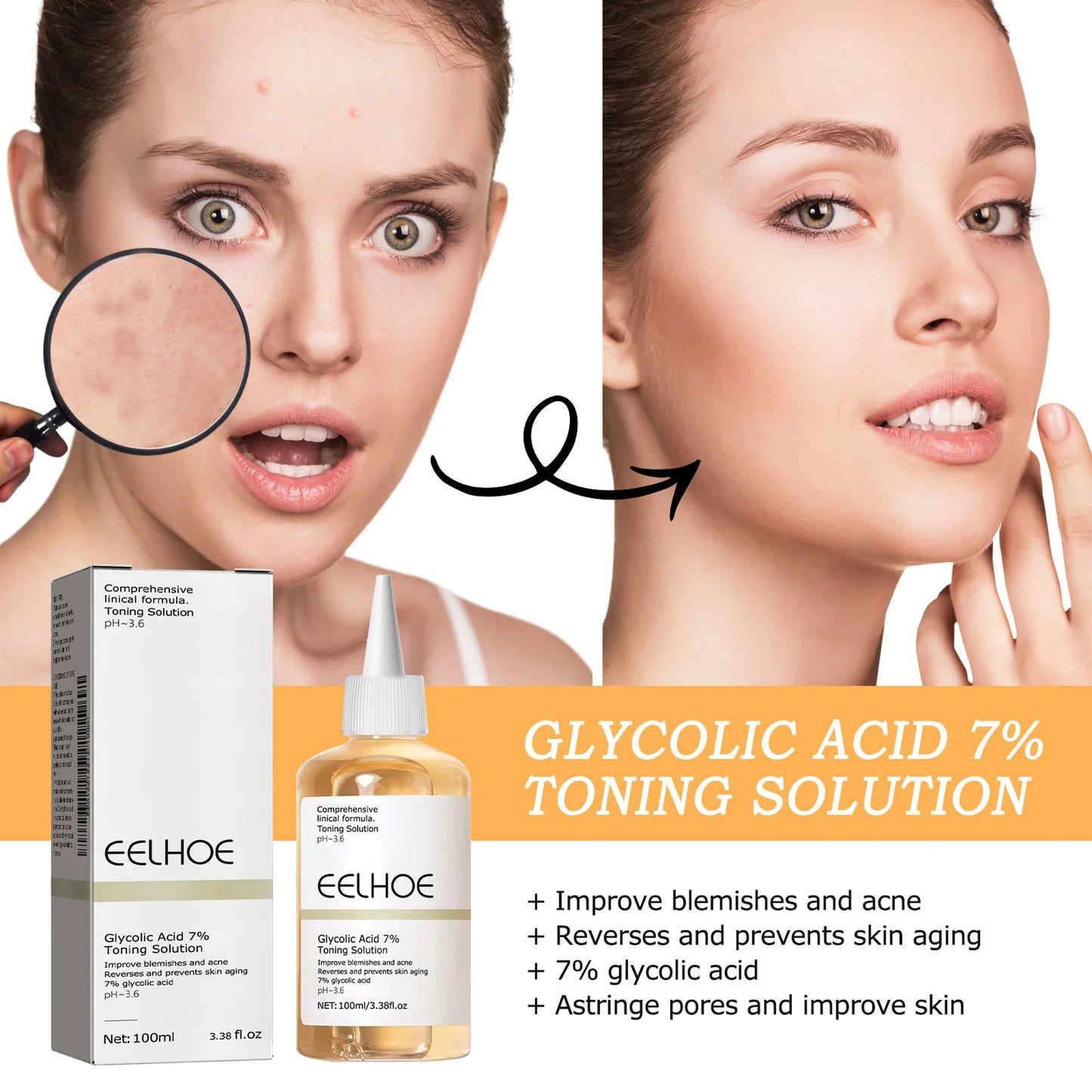 Toning Solution Ordinary Acne Remover