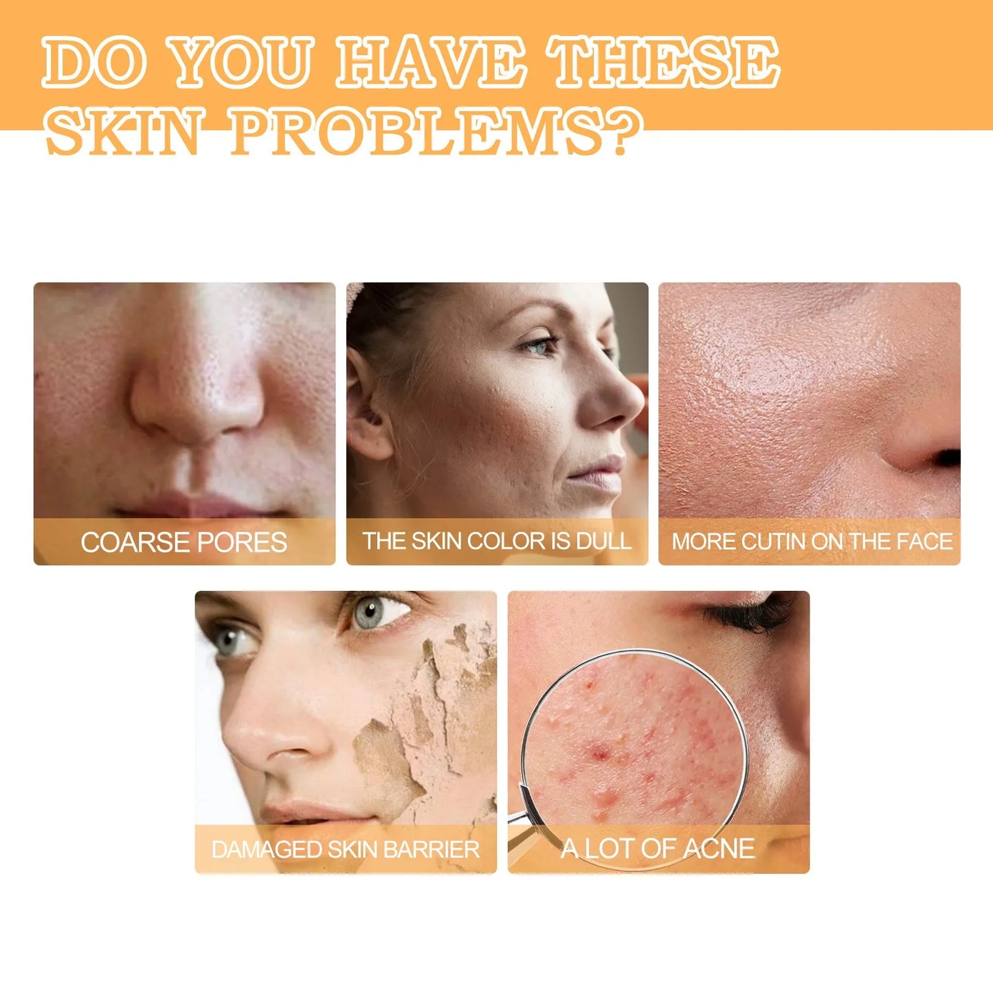 Toning Solution Ordinary Acne Remover